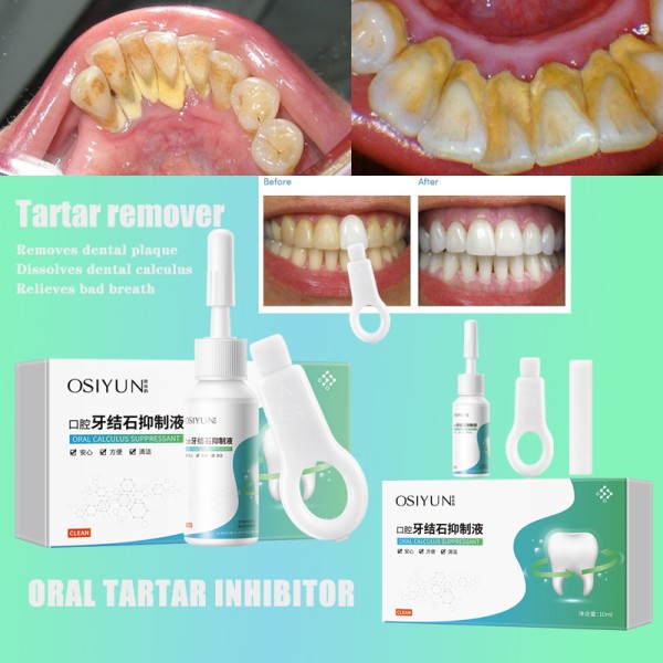 Remove Dental Serum Calculus Eliminate Bad Breath Serum Essence Teeth Whitening Natural Organic Herbal Teeth Whitening Serum