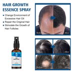Hair Growth Serum Manufacturer - Private Label Ginger Copper Peptide Oil