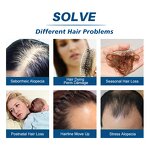 Hair Growth Serum Manufacturer - Private Label Ginger Copper Peptide Oil