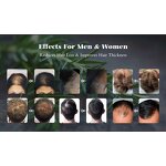 Anti-Hair Loss Shampoo Set Manufacturer - For Healthy Hair