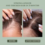 Organic Hair Growth Shampoo Supplier - 2-IN-1 Sulfate Free