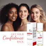 Plant-Based Hair Growth Spray Supplier - OEM/ODM Custom Formula