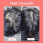 Daily Hair Growth Serum Manufacturer - Wholesale OEM