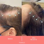 Scalp Revitalizing Spray Manufacturer - OEM/ODM Custom