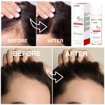 Redensyl Hair Serum Manufacturer - Bulk OEM/ODM Private Label