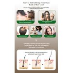 Hair Growth Shampoo Manufacturer - Sulfate-Free Formula