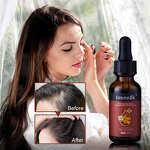 Organic Hair Growth Serum Supplier - With Jojoba Oil