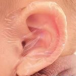 Silicone Gel Ear Patch Supplier - Hot Selling Waterproof Hearing Protection Bathing