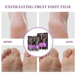 Foot Peel Mask Manufacturer - Custom Natural Organic Lavender