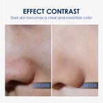 Face Serum Manufacturer - Korean Hyaluronic Acid Moisturizing Firming