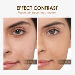 Anti Wrinkle Cream Manufacturer - OEM Custom Age Defying Instant