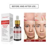 Brightening Essence Manufacturer - OEM Organic Collagen Anti Wrinkle