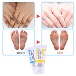 Foot Cream Supplier - Hot Selling Honey Anti-fungal Dead Skin