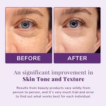 Niacinamide Pads Manufacturer - Glutathione Oil Control Pads