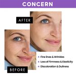 Face Serum Supplier - Peptides Bakuchiol Anti Wrinkle