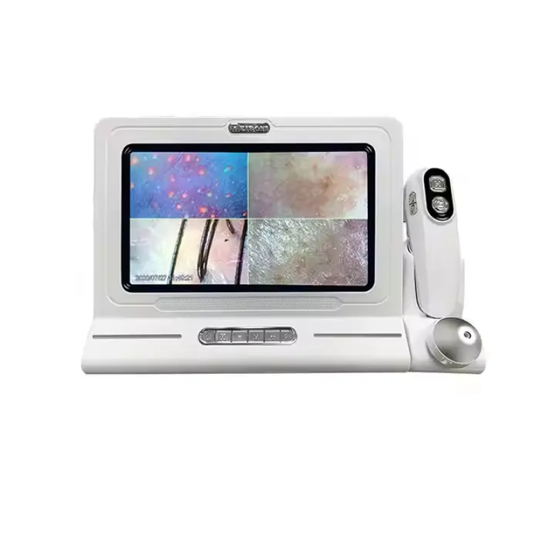 Kisen Skin and Scalp Hair Analysis Machine Hair Follicles Scalp Scanner Detector Hair Analyze 110V/220V