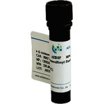 Cholesterol Esterase Manufacturer - CAS 9026-00-0 BioReagent