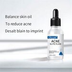 Acne Essence Supplier - Removing Facial Serum Wholesale High Quality