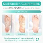 Foot Peel Mask Supplier - Natural Safe Botanical Extracts