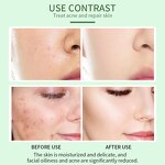 Serum Manufacturer - Vitamin B5 & C Pure Natural Antioxidant