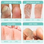Foot Peel Mask Supplier - Natural Safe Botanical Extracts