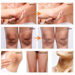 Underarm Whitening Supplier - Natural Organic Fast Instant Private