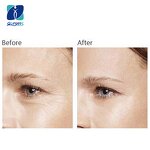 Retinaldehyde Supplier - Retinal Vitamin A Aldehyde CAS 116-31-4