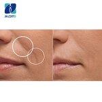 Retinaldehyde Supplier - Retinal Vitamin A Aldehyde CAS 116-31-4