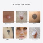 Portable Home Picosecond Laser Tattoo Removal/ Tattoo Freckle Removal Mole Dark Spot Laser Pen