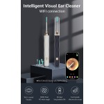 电动耳锥工具耳垢清除套件1080P耳清洁器耳镜与相机光耳垢清除