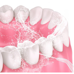 Dental Flosser Supplier - Electric Water Jet Teeth Cleaner for Braces 200ML