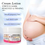 Source Manufacturer: Stretch Mark Lightening Cream, Pregnant Women Repair Scars, Obesity Lines Firming Massage Cream