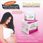 Source Manufacturer: Stretch Mark Lightening Cream, Pregnant Women Repair Scars, Obesity Lines Firming Massage Cream