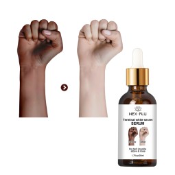 暗指关节快速美白血清色素沉着手指关节肘部膝盖强烈污渍去除血清