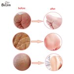 Electric Pedicure File Manufacturer - OEM/ODM Rechargeable Foot Scrubber Callus