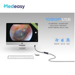 Medical USB Endoscope Camera Supplier - Waterproof for ENT Surgery