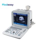 Pocket Portable Ultrasound Manufacturer - Special Design Full Digital LED