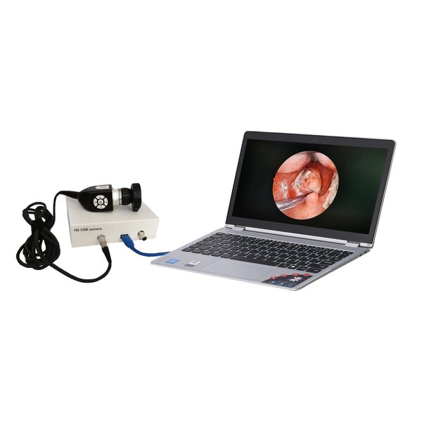 Multi-output Endoscope Camera Manufacturer - Medical Full HD 1080P USB