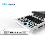 Portable Wireless Ultrasound Manufacturer - Hot Selling Mini 2 in 1 Custom