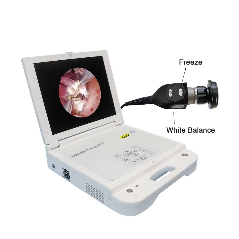 Full HD Portable Endoscopy Camera Unit Supplier - System with Monitor Light Recorder