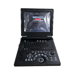 Portable Color Doppler Ultrasound Manufacturer - 12 Inch HD Display 3D Pregnancy