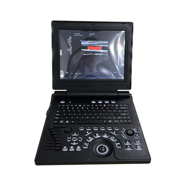 Portable Color Doppler Ultrasound Manufacturer - 12 Inch HD Display 3D Pregnancy
