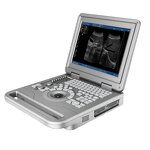 Portable Ultrasonic Manufacturer - Metal-look Fully Digital LED Therapy