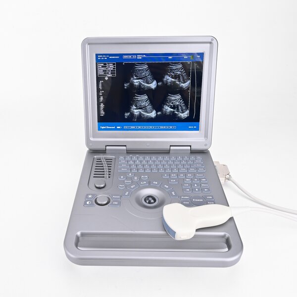 Handheld Ultrasound Scanner Factory - 12 Inch White Black Device with Probe