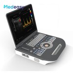 Color Doppler Ultrasound Scanner Supplier - Mindray 4d Portable Attractive Price