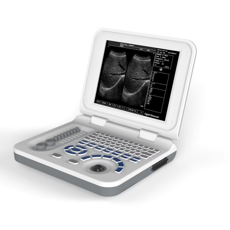 Veterinary Ultrasound Scanner Factory - Portable 10 Inches 3.5 MHz Convex