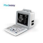 Pocket Portable Ultrasound Manufacturer - Special Design Full Digital LED