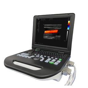 Color Doppler Ultrasound Factory - Portable 3D Image Pregnancy Diagnostic