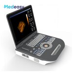 Color Doppler Ultrasound Scanner Supplier - Mindray 4d Portable Attractive Price