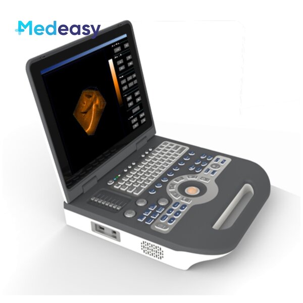 Color Doppler Ultrasound Scanner Supplier - Mindray 4d Portable Attractive Price